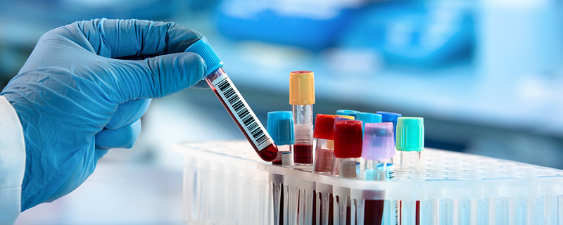 用水稻造“人血”？！武汉禾元生物冲刺科创板IPO，技术路线尚需验证