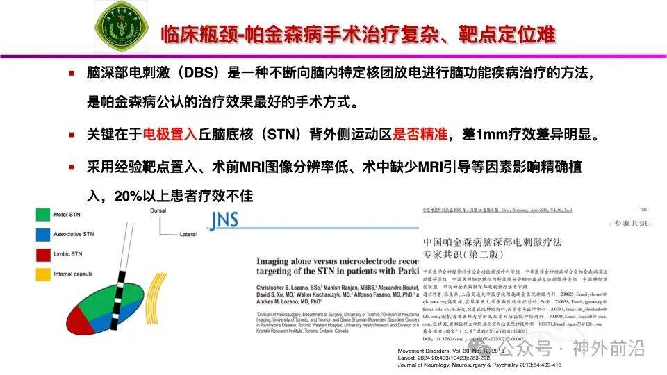 盈康生命：公司旗下运城医院完成23例脑起搏器植入术（DBS），为帕金森患者提供创新治疗方案