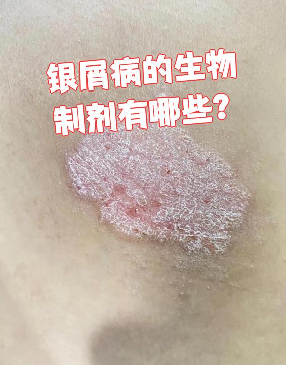 申联生物最新公告：联营公司获得艾滋病单抗发明专利